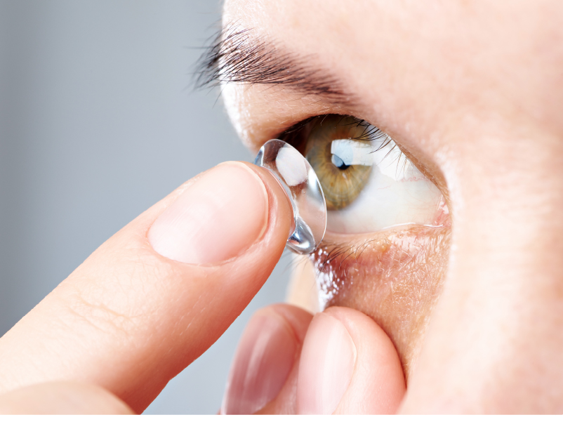 オルソケラトロジー(自費)